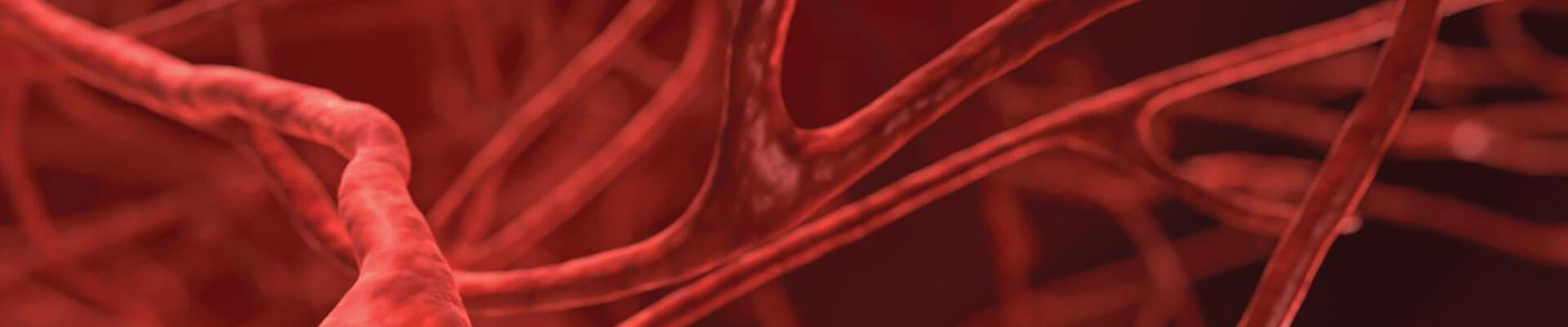 cirugia_vascular_endovascular_ivei