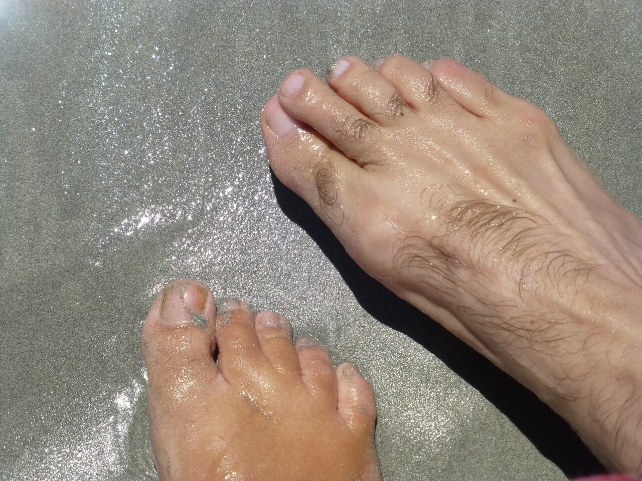 Los hongos en las uñas de los pies suelen ser difíciles de eliminar  completamente  Red de noticias de Mayo Clinic