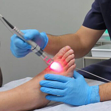 laserterapia