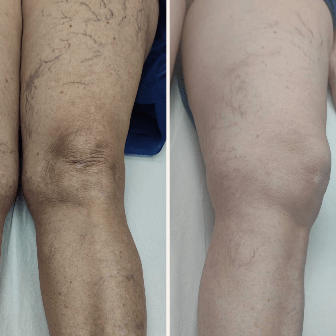 06-02-2023 - 27-03-2023. 1 sesión