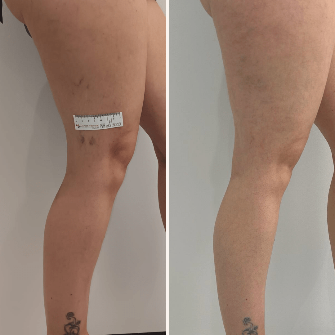 09_10_2023 - 05_02_2024. 2 sesiones