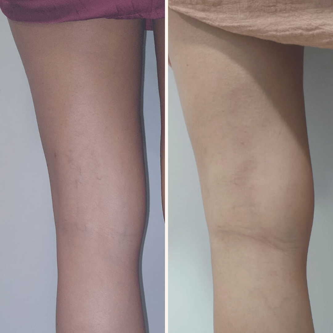 11_09_2023 - 09_09_2024. 1 sesión