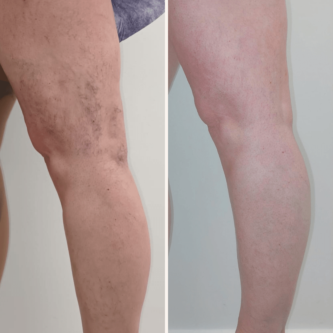 14_06_2023 - 23_03_2024. 3 sesiones