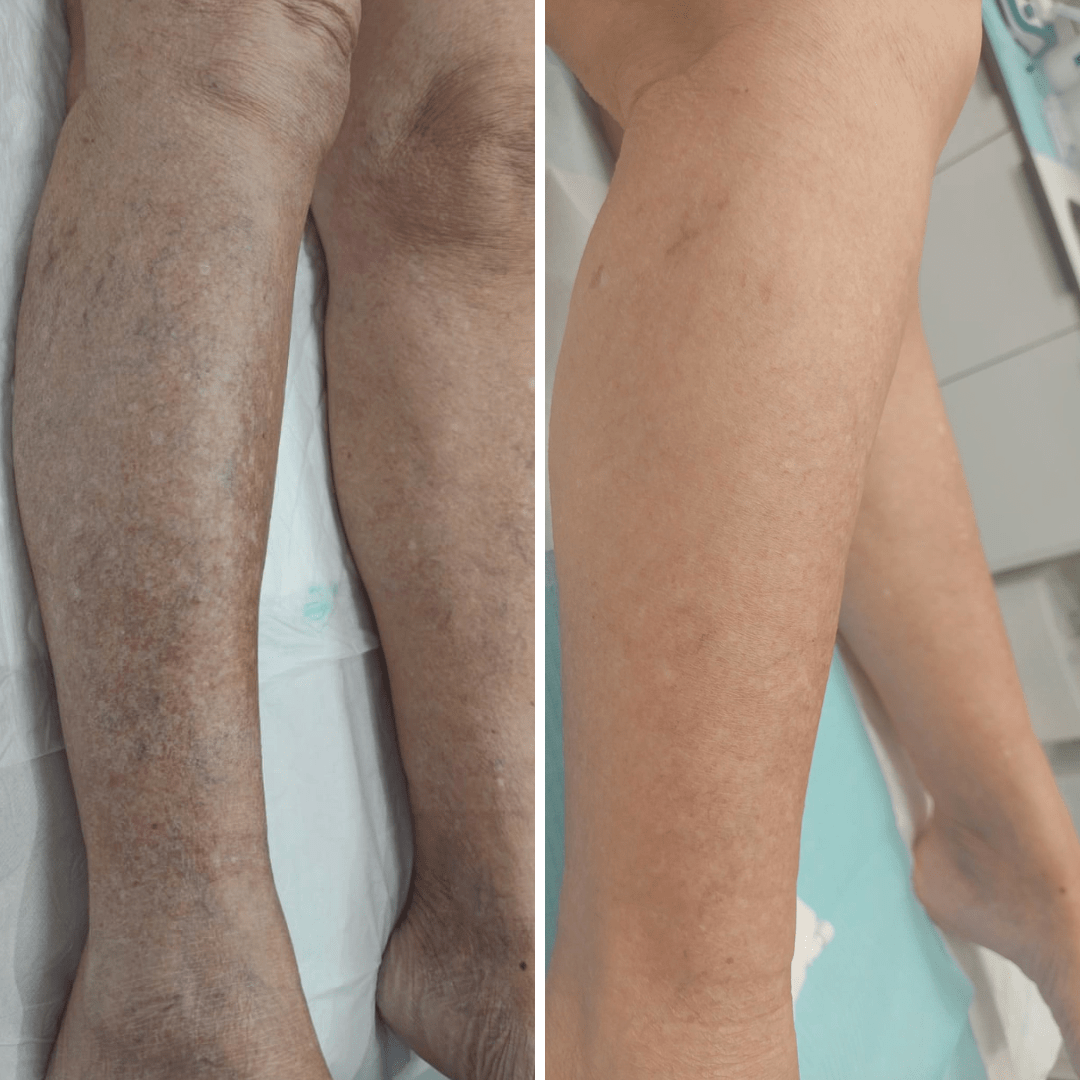 18_01_2023 - 06_03_2023. 1 sesión