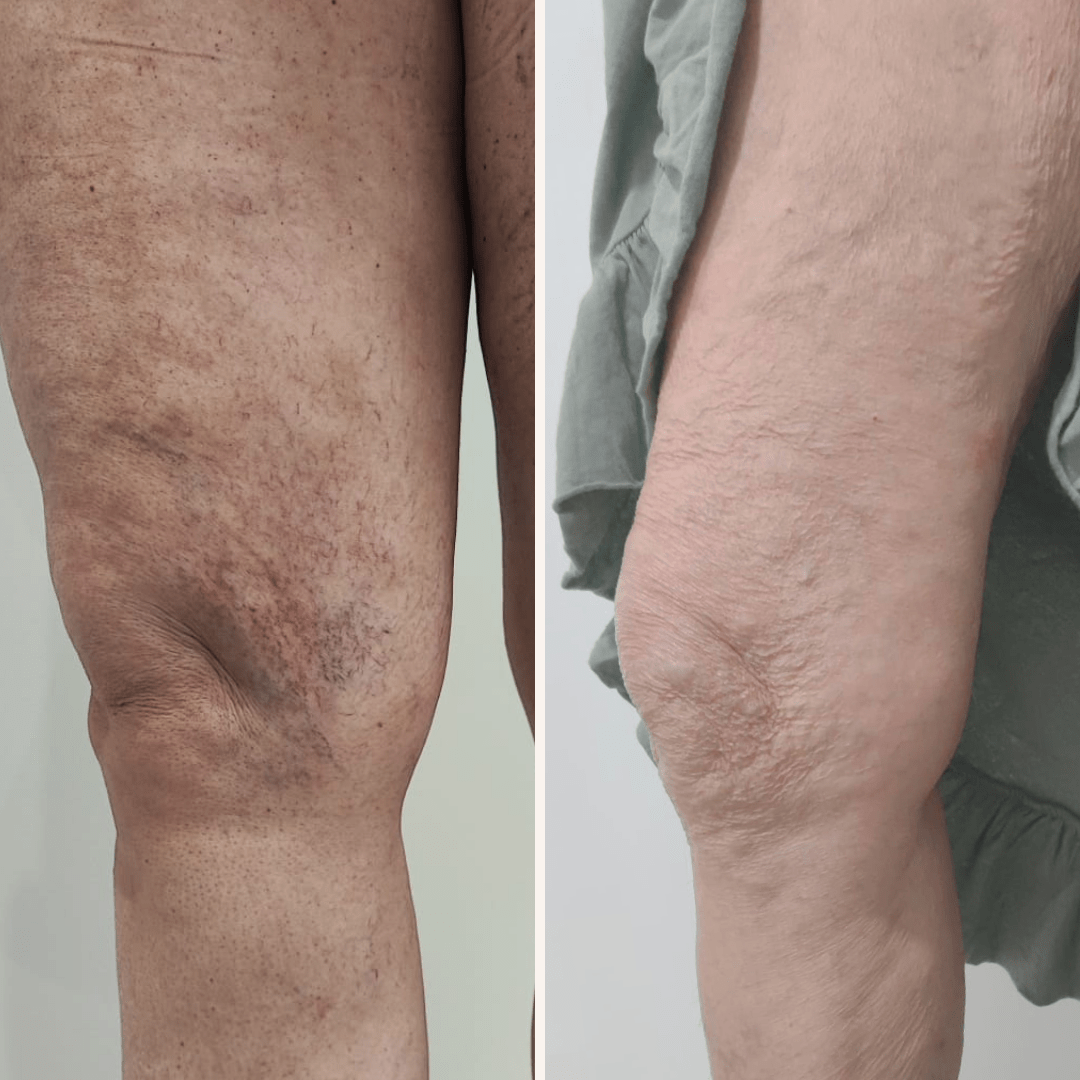 22_01_2024 - 21_10_2024. 1 sesión