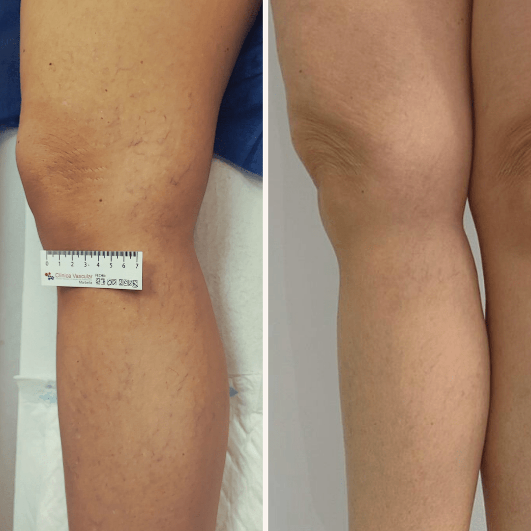 27_02_2023 - 05_02_2024. 2 sesiones integrales