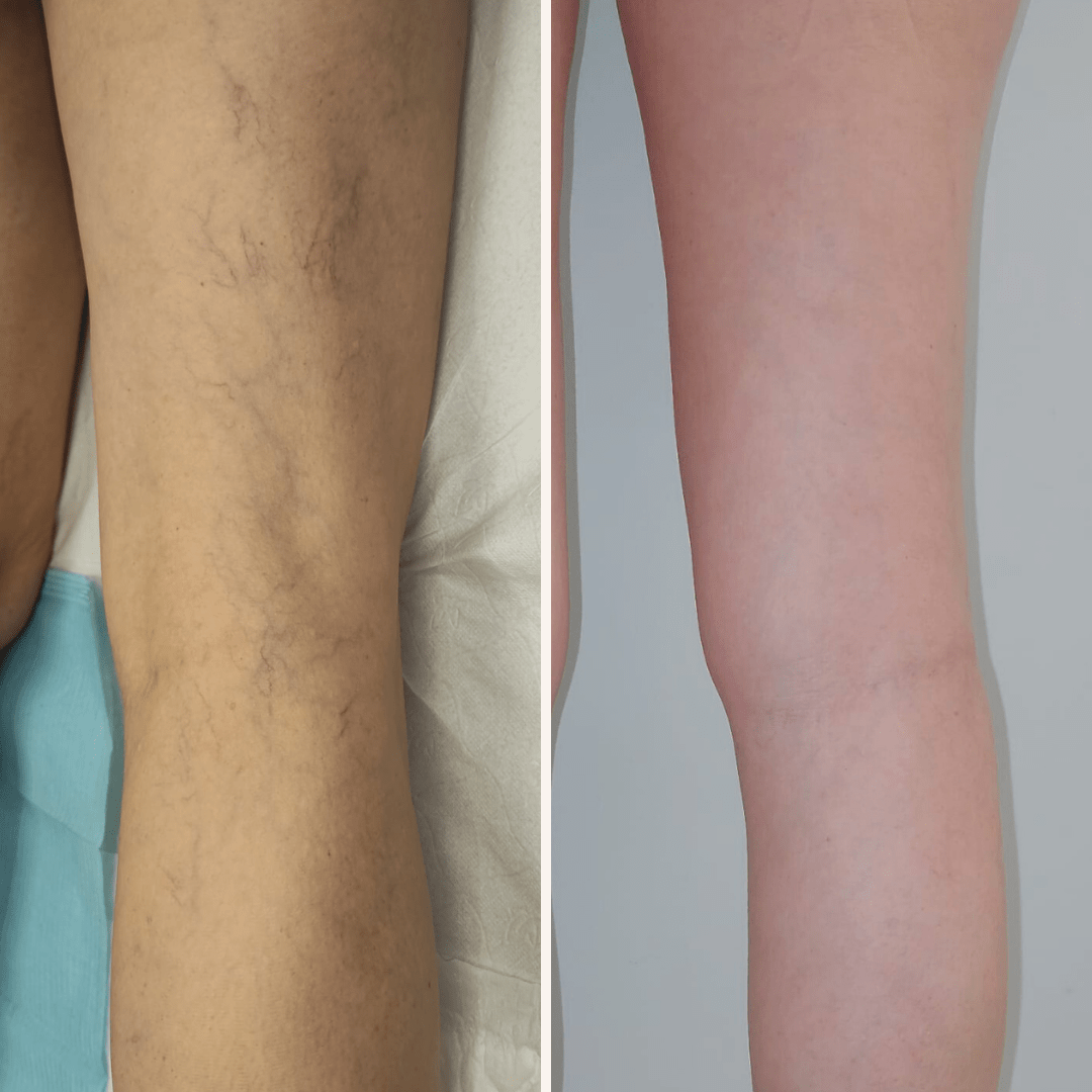 27_02_2023 - 29_05_2023. 2 sesiones